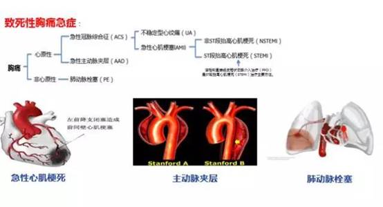 說明:胸痛中心6